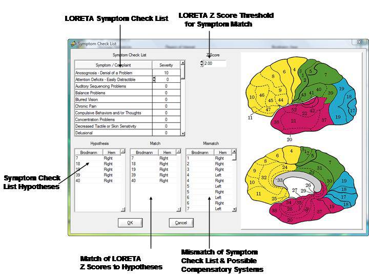 Swloreta Z Score Neurofeedback Applied Neuroscience Inc