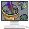 NeuroNavigator's Diffusion Tensor Imaging Overlay for a 2nd NG License