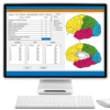 QEEG Edits and Neurofeedback Protocol Generation